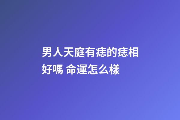 男人天庭有痣的痣相好嗎 命運怎么樣